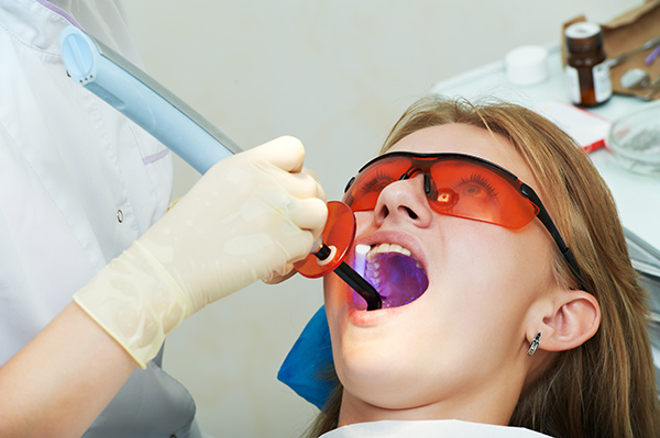 Dentist applying sealants for teeth using a curing light
