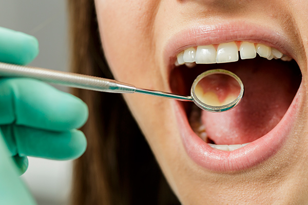 Dentist checking for effects of gum disease on patient’s mouth.