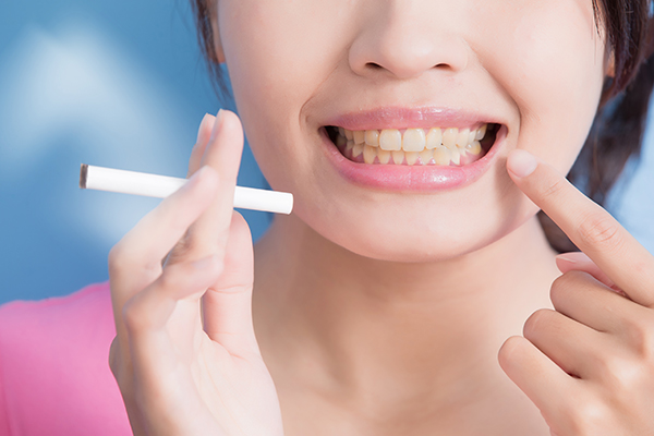 A woman pointing to yellow-stained teeth while holding a cigarette